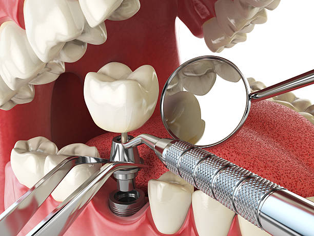 Best Teeth Whitening  in Merrimac, VA
